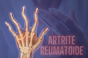 Artrite reumatóide o que é? E como a psicoterapia reconstrutiva pode ajudar.